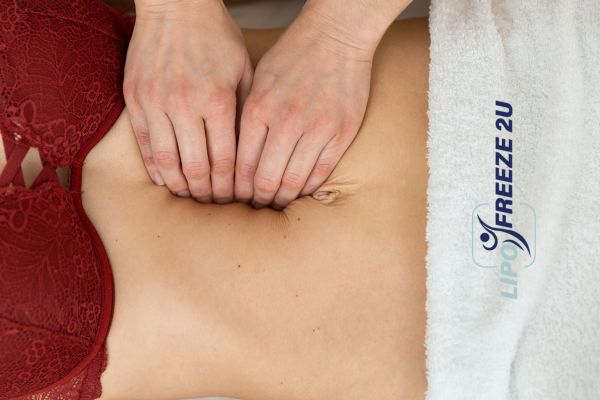 diastasis recti treatment Stoke