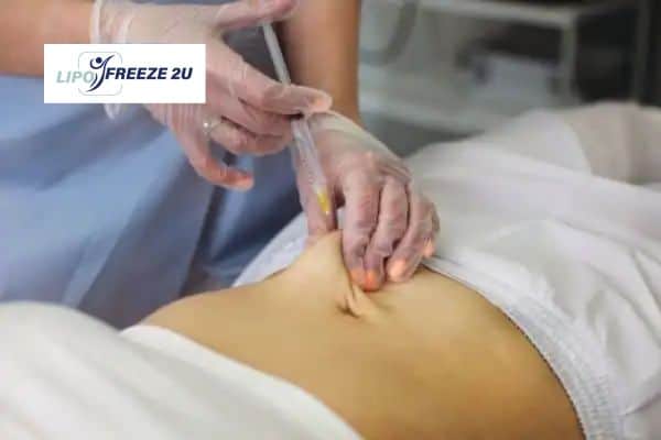 How Does Aqualyx Fat Dissolving Injection Work to Break Down Fat Stoke?