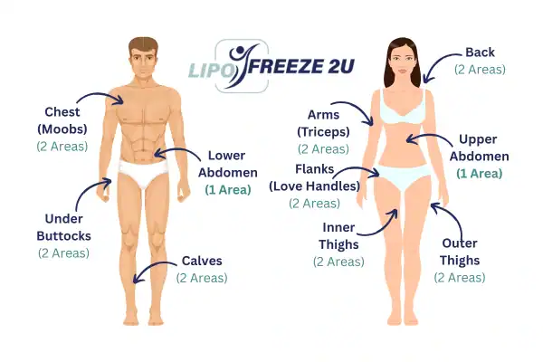 Areas you can have fat freezing treatment Stoke