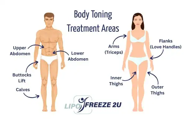 Graphic showing where you can have Body toning Treatment Stoke on your body