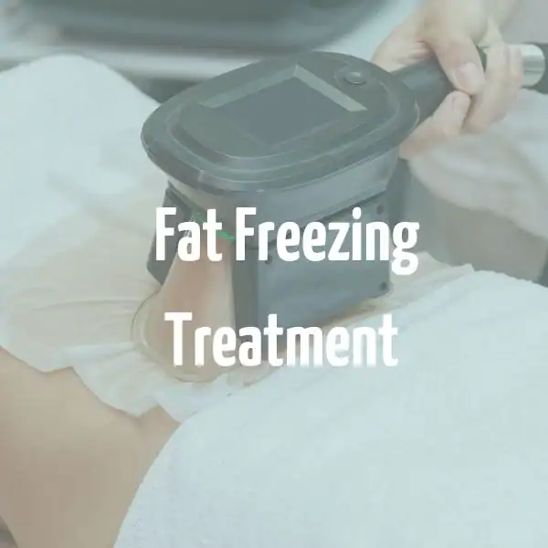 fat freezing treatment Stoke