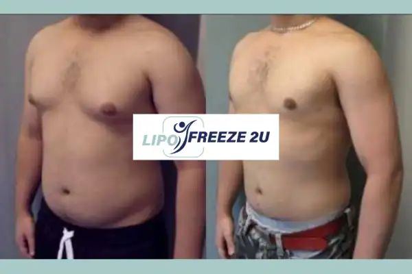 How Long Does It Take to See Results Stoke?