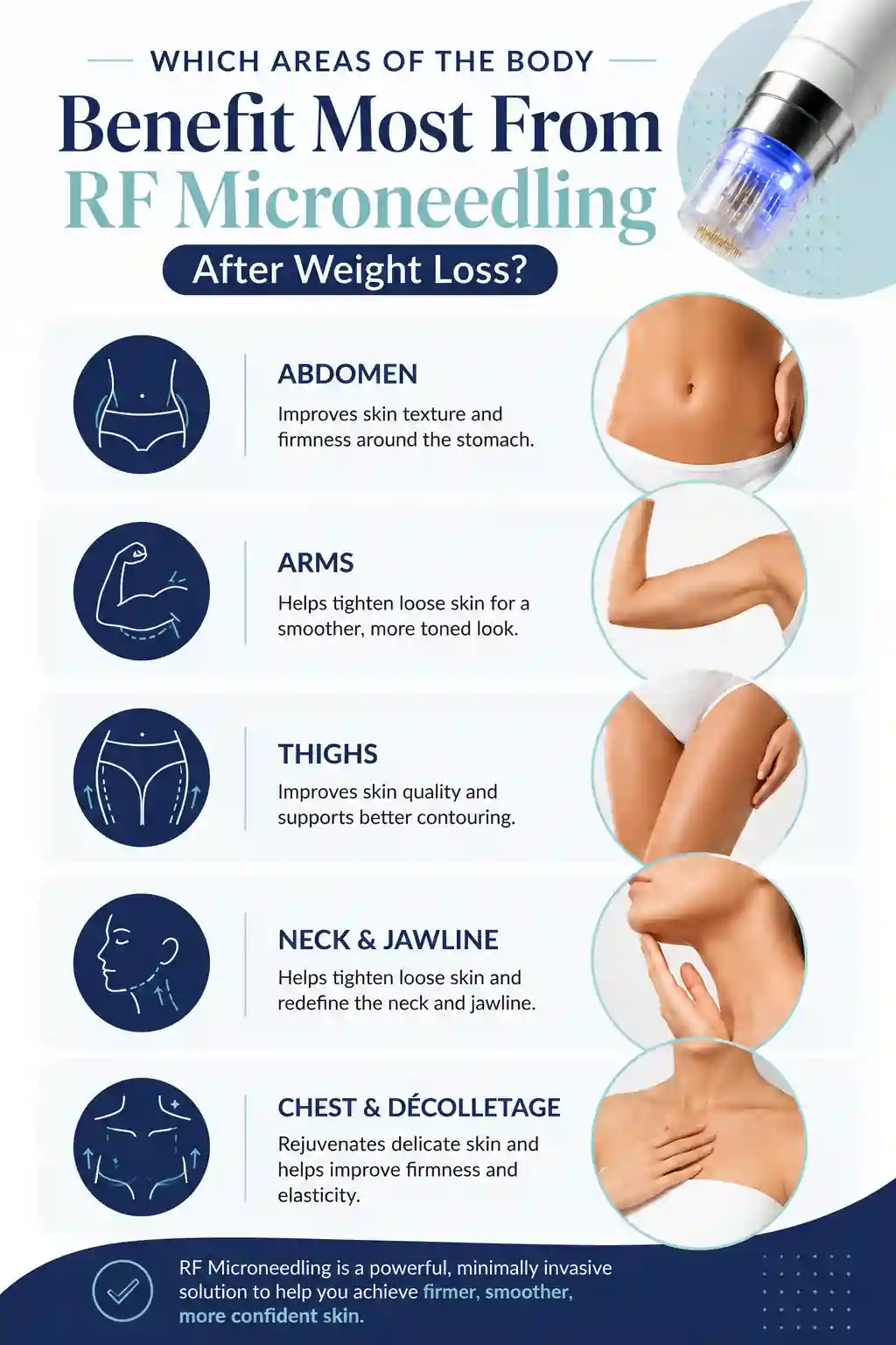 Which Areas of the Body Benefit Most From RF Microneedling After Weight Loss Stoke